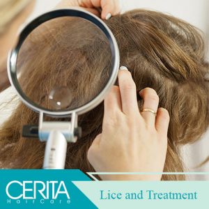 Lice and its Treatment